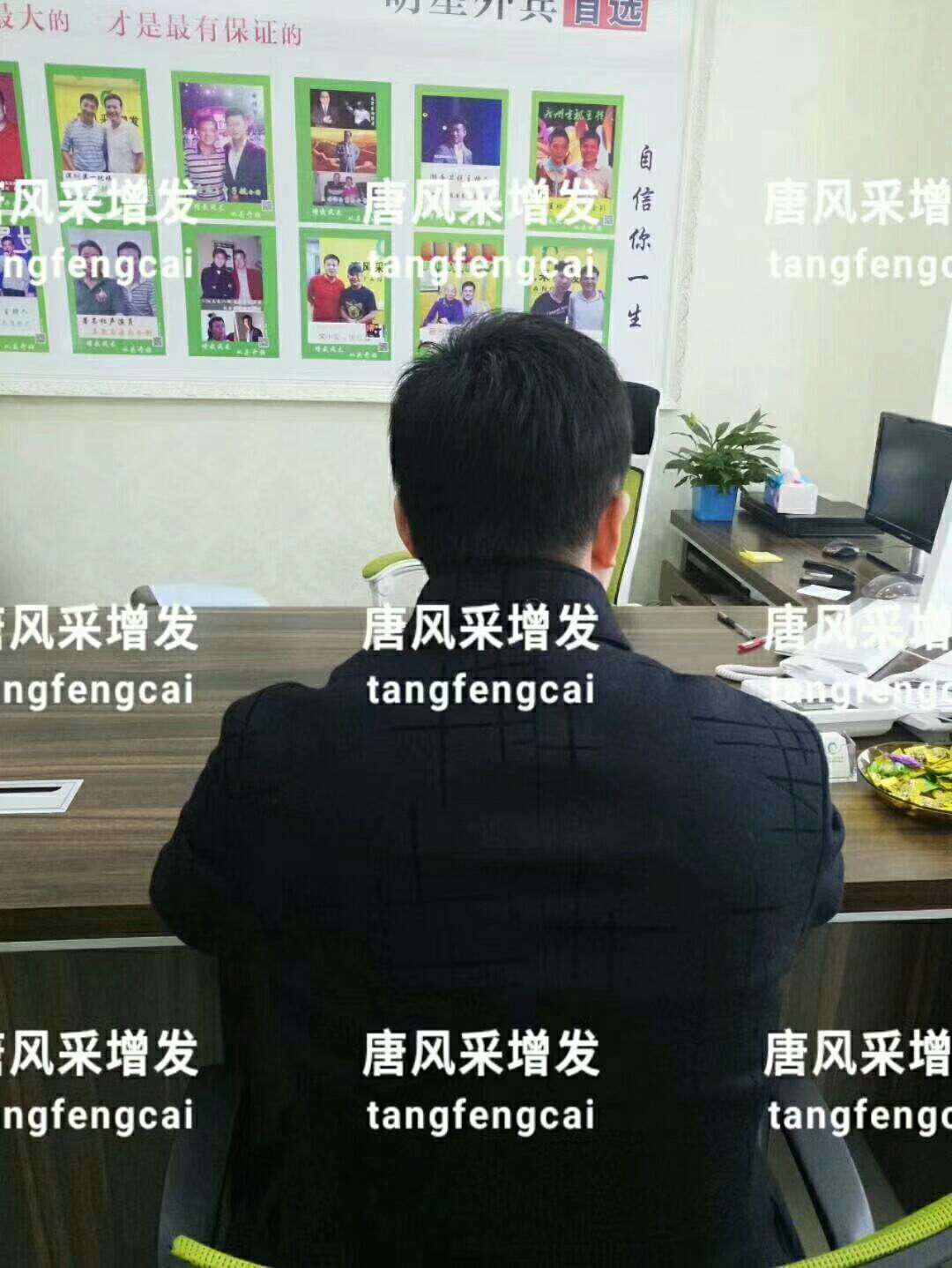  一轉(zhuǎn)眼年輕十歲，你差的就是這點(diǎn)點(diǎn)頭發(fā)！