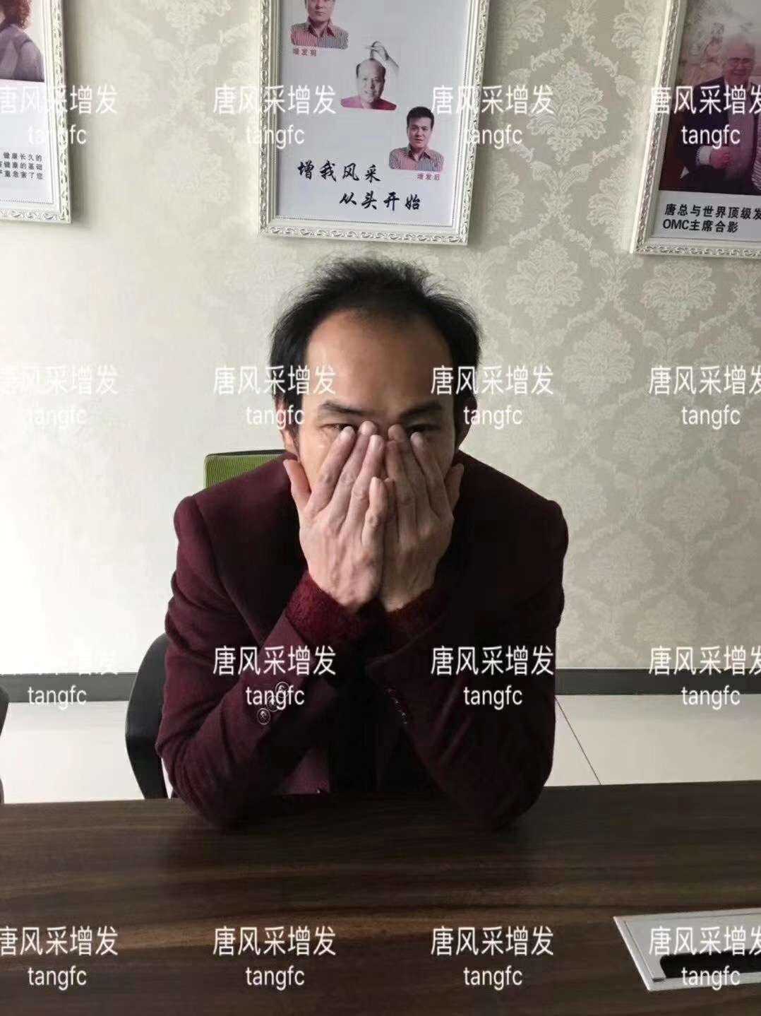 一轉(zhuǎn)眼年輕十歲，你差的就是這點(diǎn)點(diǎn)頭發(fā)！