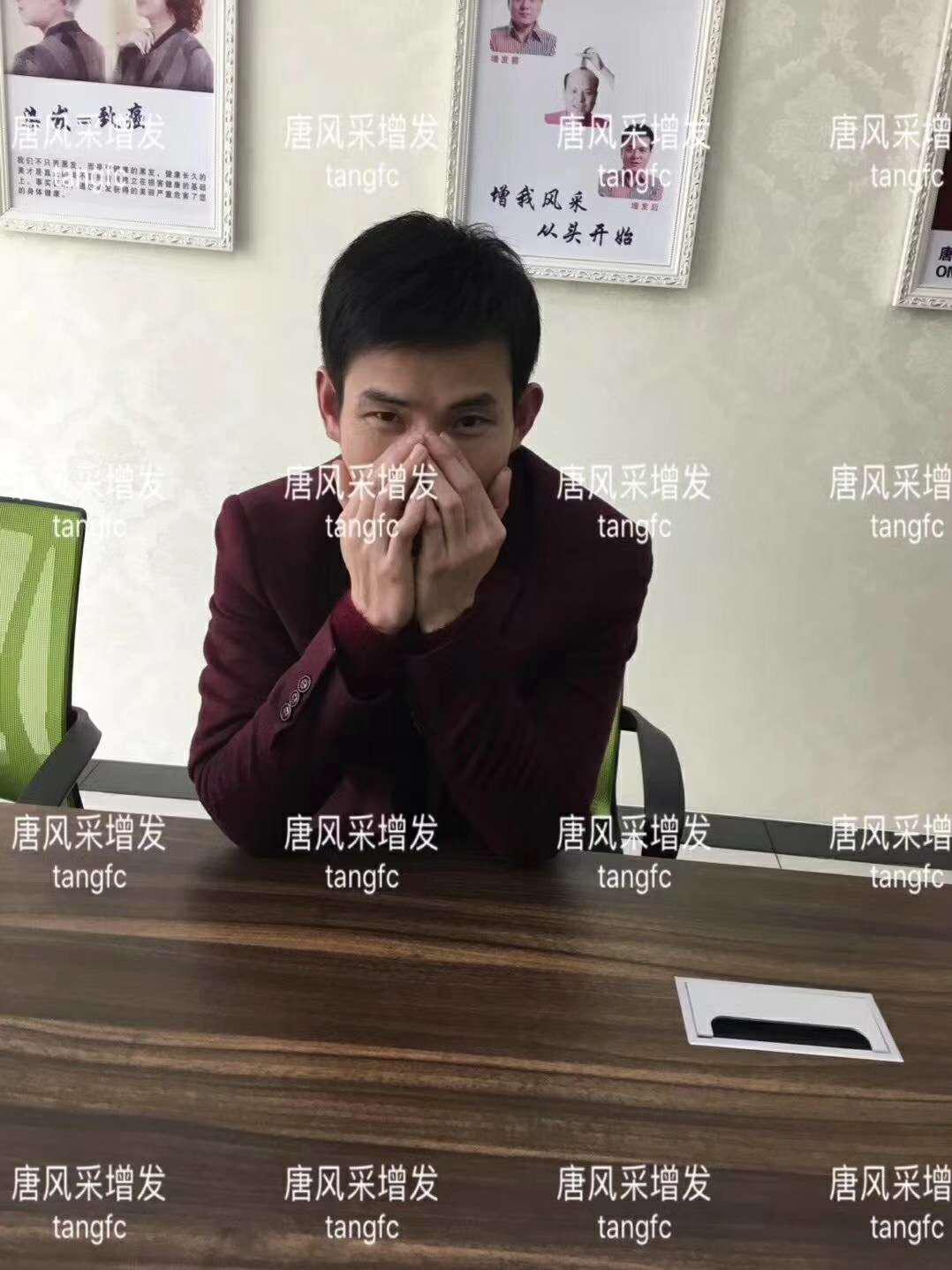  一轉(zhuǎn)眼年輕十歲，你差的就是這點(diǎn)點(diǎn)頭發(fā)！