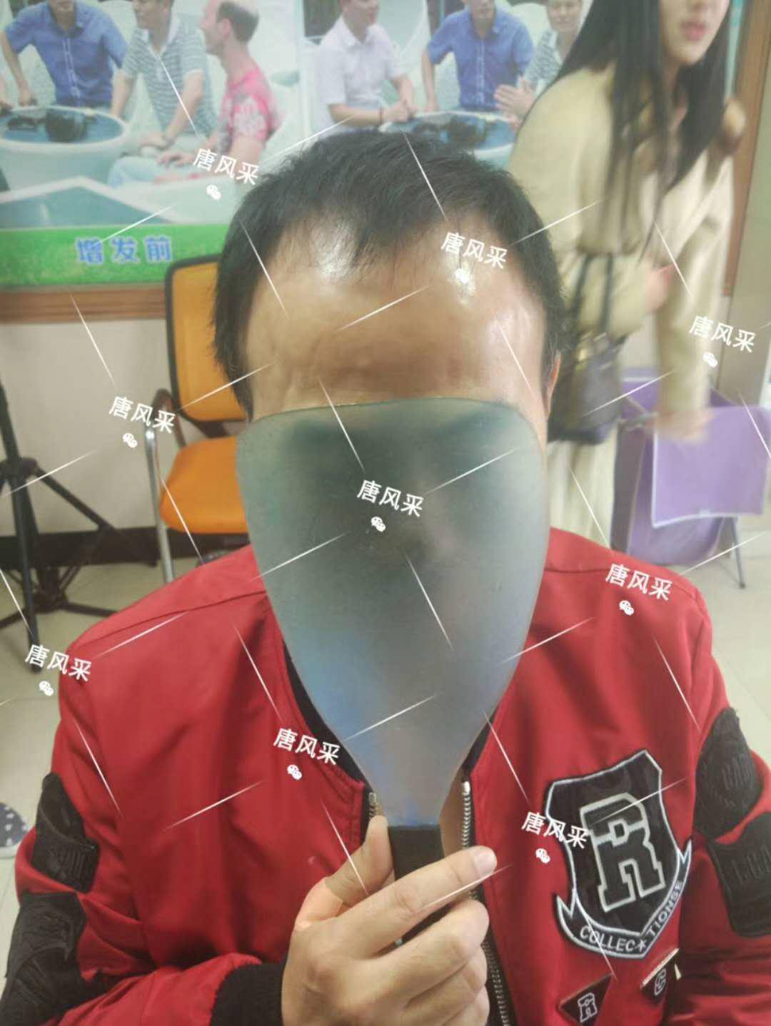  一轉(zhuǎn)眼年輕十歲，你差的就是這點(diǎn)點(diǎn)頭發(fā)！