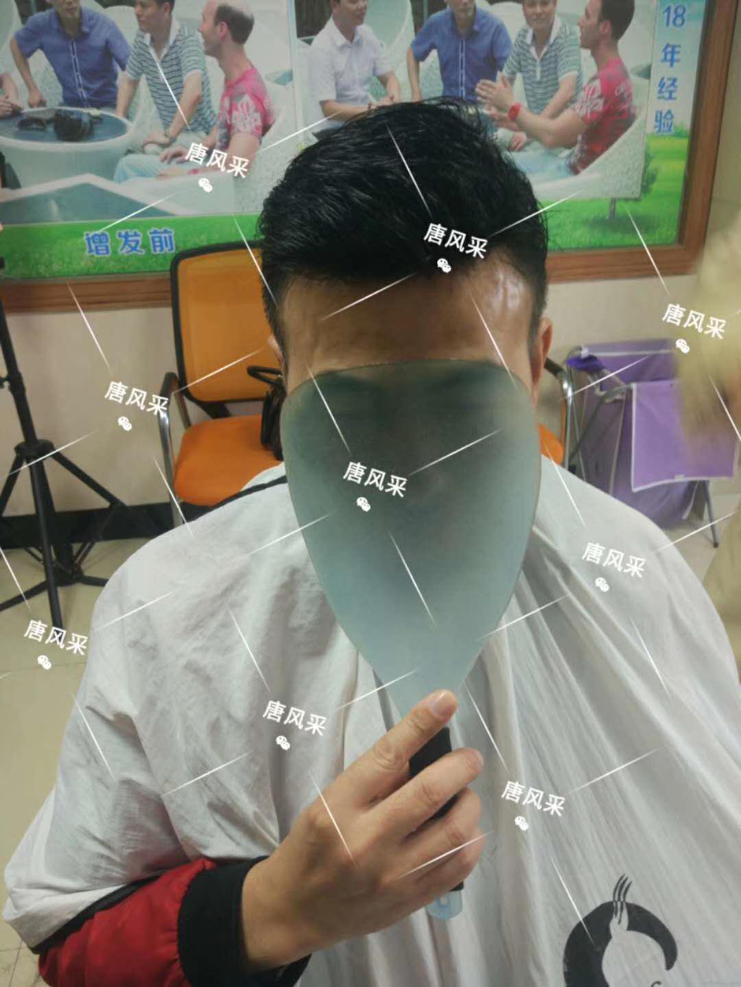  一轉(zhuǎn)眼年輕十歲，你差的就是這點(diǎn)點(diǎn)頭發(fā)！