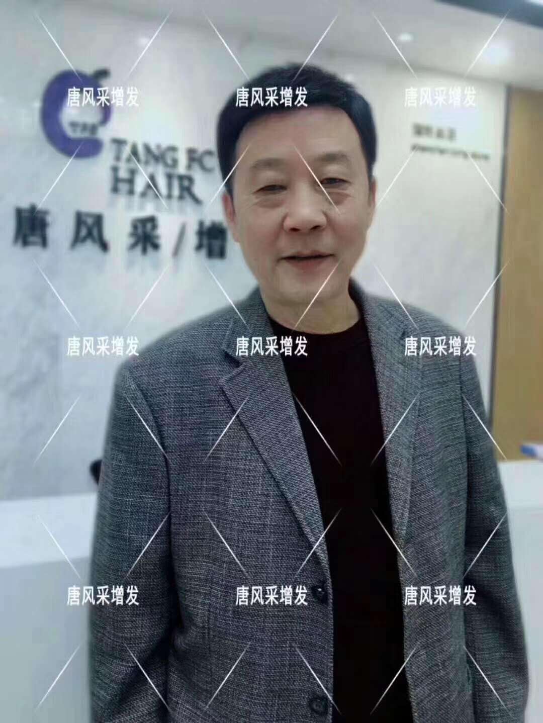 常按這個穴位好處多多 有助睡眠還能減少白頭發(fā)！