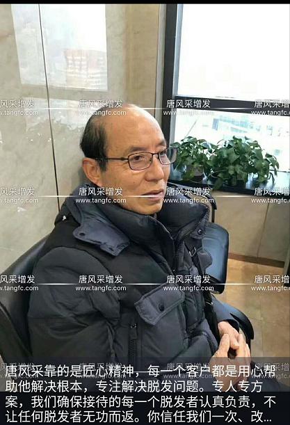大爺大叔傻傻分不清楚？——唐風(fēng)采假發(fā)案例展示