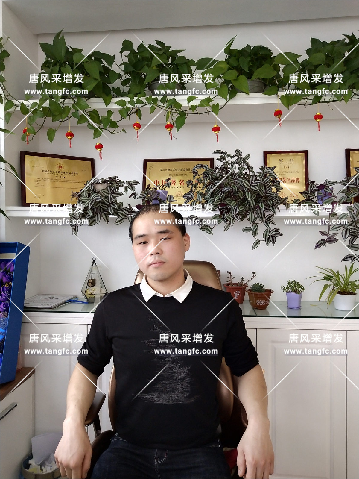 增發(fā)還是植發(fā)，這是個(gè)問(wèn)題！