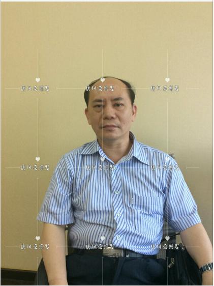 存款重要還是頭發(fā)重要？聽聽李先生怎么說！