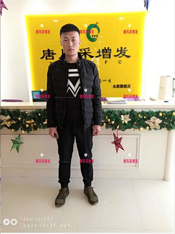 好形象擁抱新生活，唐風(fēng)采助力脫發(fā)新青年！