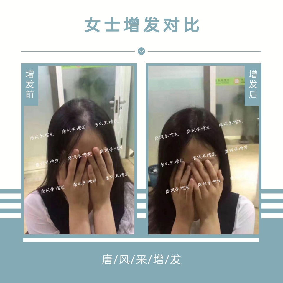 母親節(jié)：我能想到最美好的事，就是把媽媽的青春留?。? src=