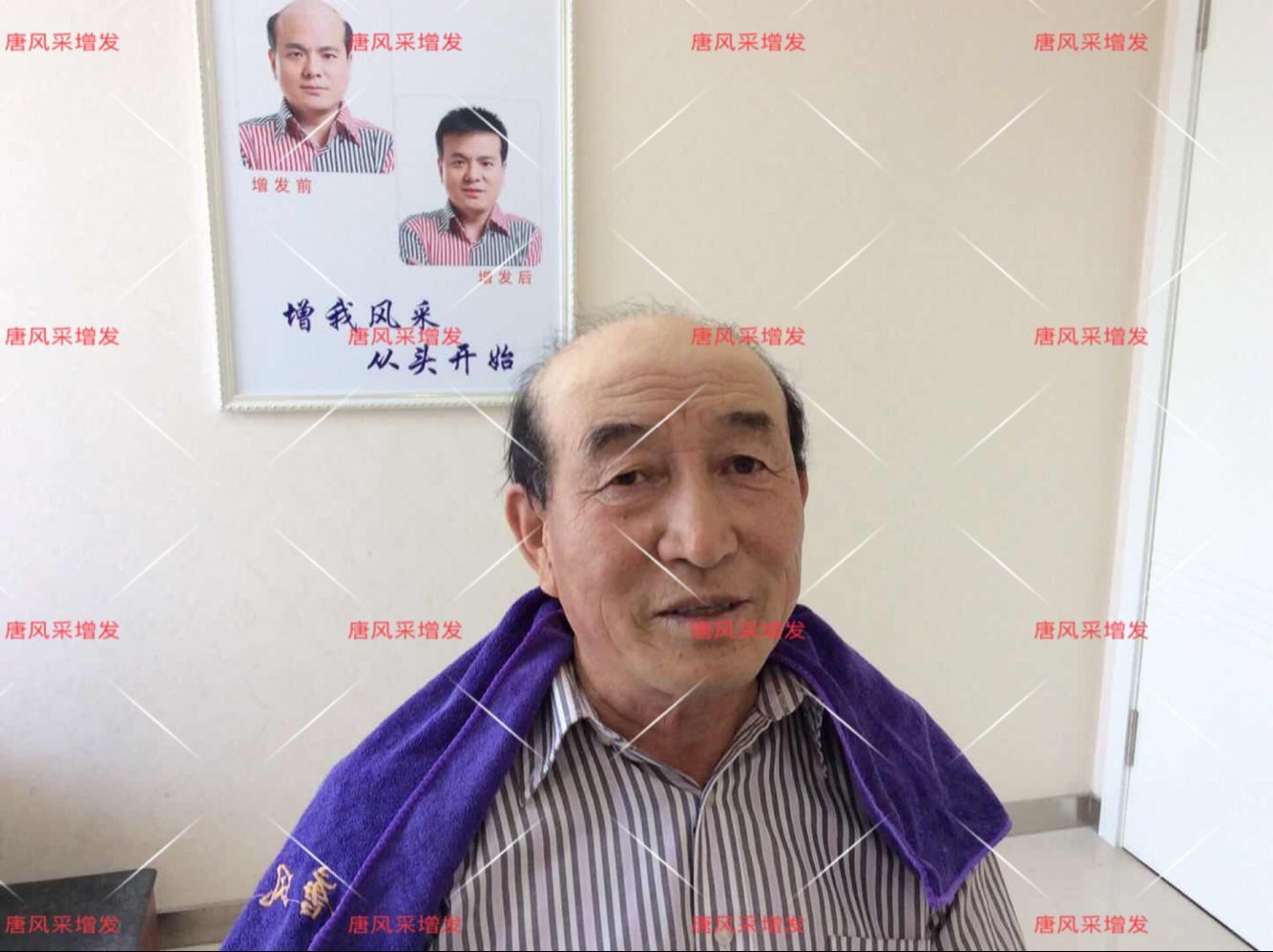 朝陽耿直大叔2年內苦尋三次唐風采假發(fā)，2018終于不虛此行