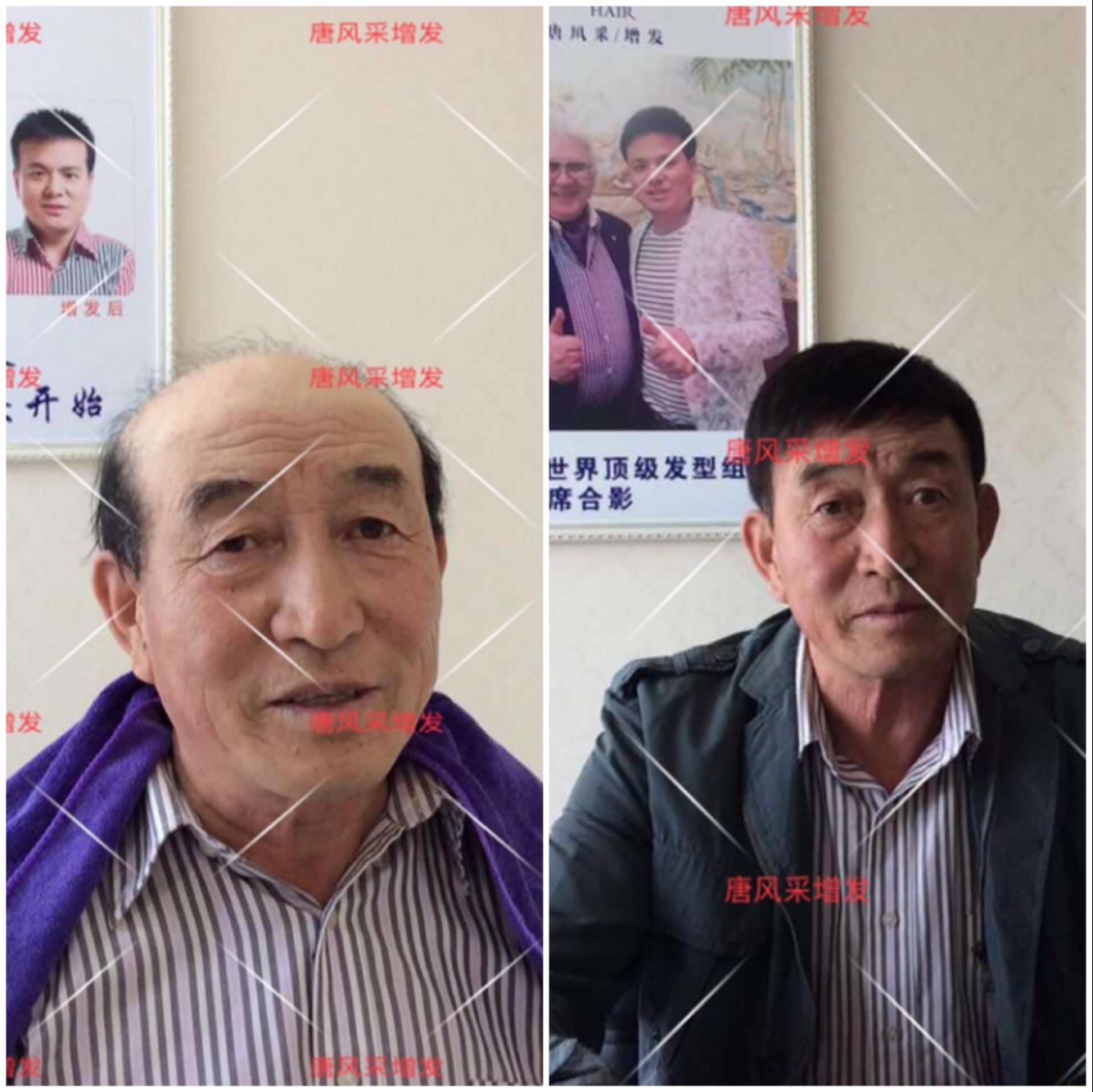 朝陽耿直大叔2年內苦尋三次唐風采假發(fā)，2018終于不虛此行