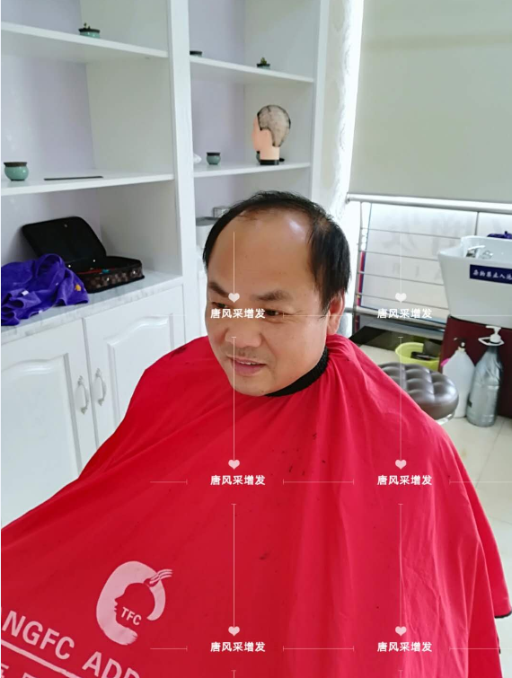 脫發(fā)不分地域，唐風(fēng)采假發(fā)助力北京爺們