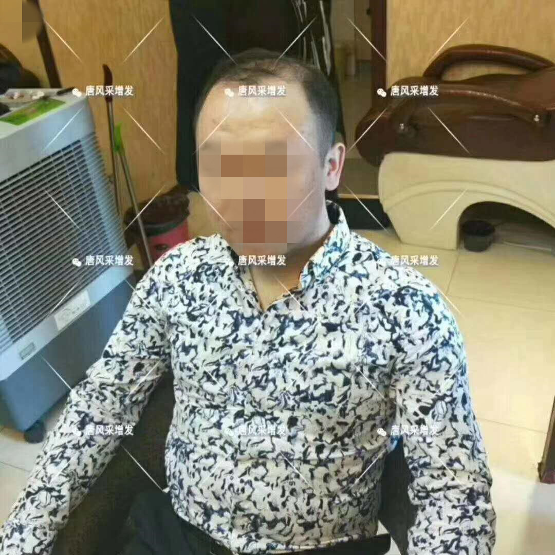 春夏季最新帥氣發(fā)型，頭發(fā)再少也能hold住！