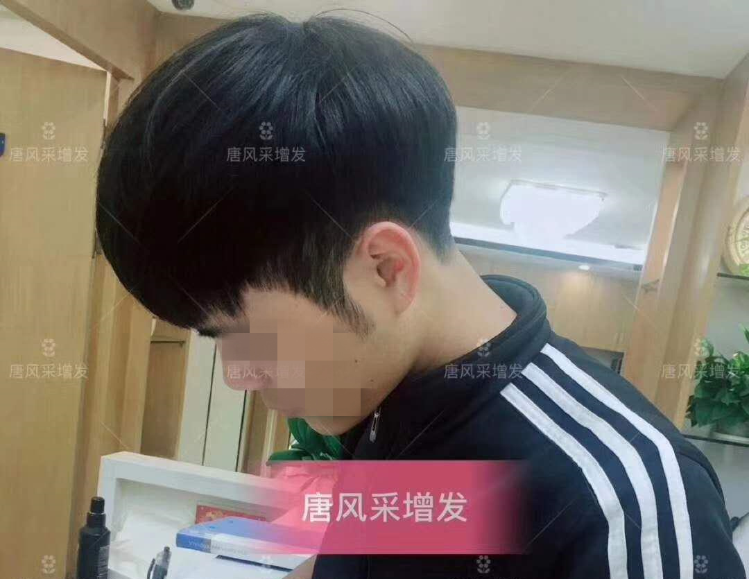 春夏季最新帥氣發(fā)型，頭發(fā)再少也能hold住！