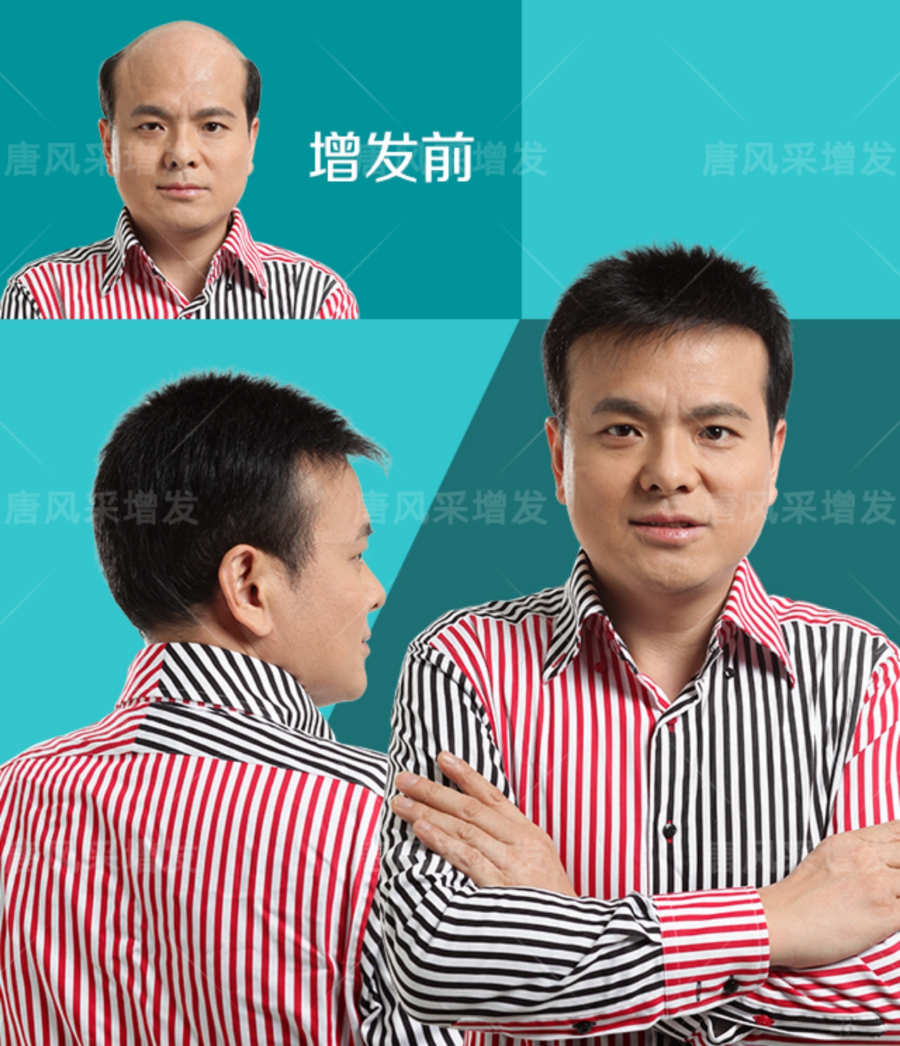 稀發(fā)不哭！終于知道頭發(fā)稀疏可以這樣做！