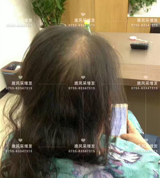 讓頭發(fā)一直好好的，唐風(fēng)采就是這般任性！