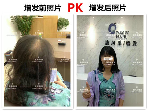 頭發(fā)稀少也能擁有一頭好發(fā)型，不信請看！