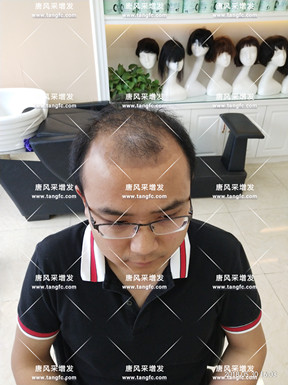 唐風(fēng)采假發(fā)效果能否達到預(yù)期？看看圖先！