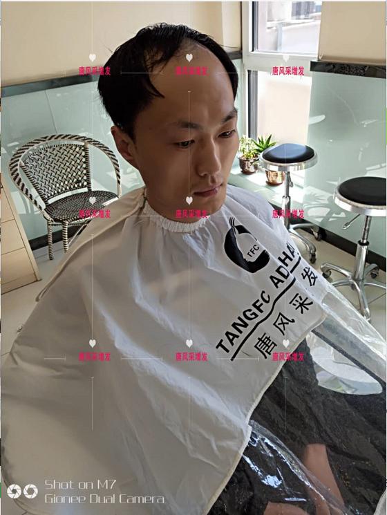 男士假發(fā)套價(jià)格貴嗎？買(mǎi)多少錢(qián)的效果看起來(lái)才逼真？