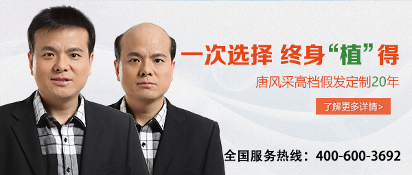 為什么我脫發(fā)這么嚴重卻還是一頭濃密發(fā)？