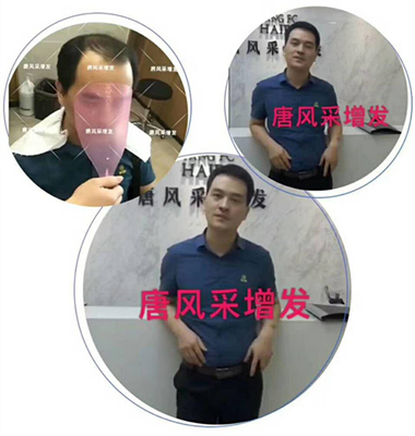 光禿禿的院子光禿禿的頭，與其羨慕不如改變！