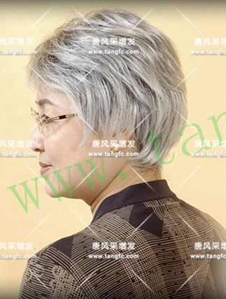 光禿禿的院子光禿禿的頭，與其羨慕不如改變！