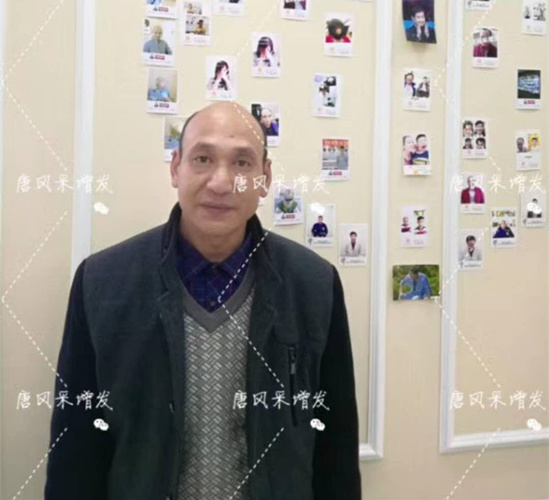 《我不是藥神》火了，山爭哥哥光頭變“藥神”成熱門話題！