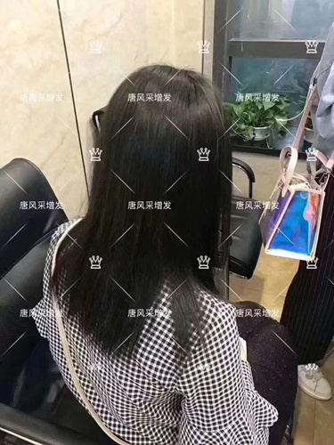 西寧織發(fā)補(bǔ)發(fā)需要多少錢,哪家補(bǔ)發(fā)技術(shù)好？