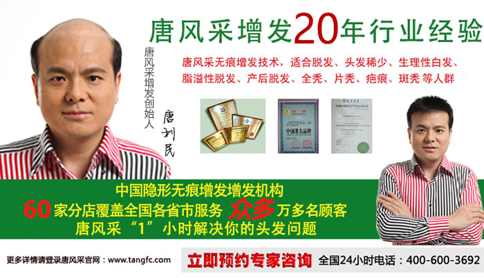 頭發(fā)稀少了，用唐風(fēng)采假發(fā)能保持頭發(fā)的傲嬌！