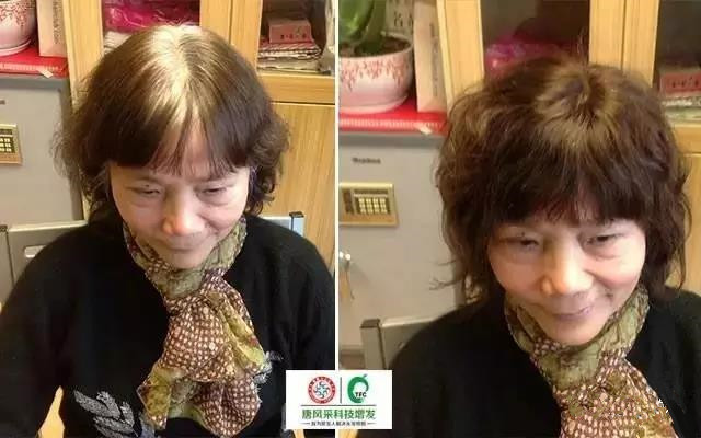 治白發(fā)不如遮白發(fā)，這個(gè)方法最有效！