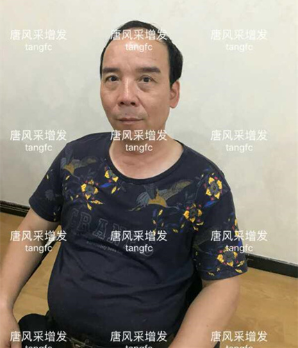 朋友碰面不敢認(rèn)，直擊發(fā)友增發(fā)后的真實(shí)改變！