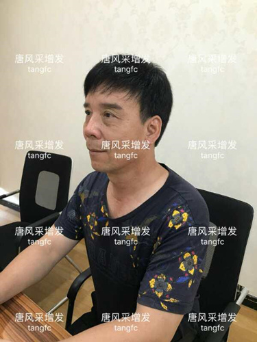 朋友碰面不敢認(rèn)，直擊發(fā)友增發(fā)后的真實(shí)改變！