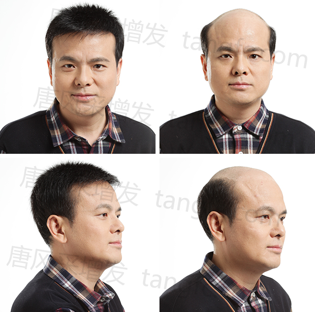 常剃光頭后，頭發(fā)變好了？這是視覺(jué)效果！