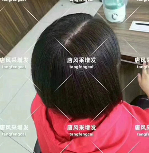 唐風(fēng)采假發(fā)客戶案例