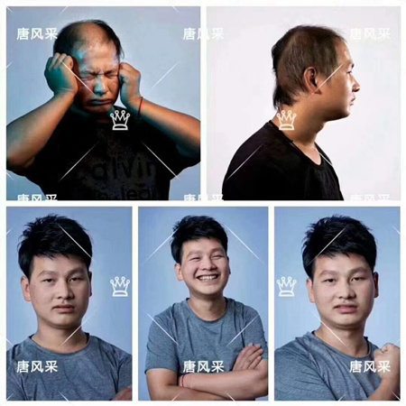 補發(fā)增發(fā)