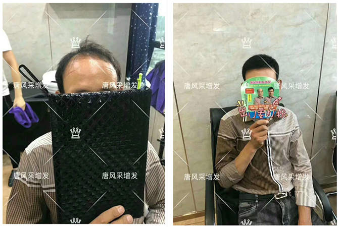 唐風(fēng)采假發(fā)客戶案例