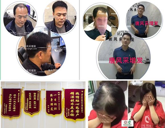 唐風(fēng)采假發(fā)案例