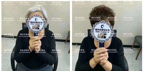 頭發(fā) 增發(fā)后對(duì)比