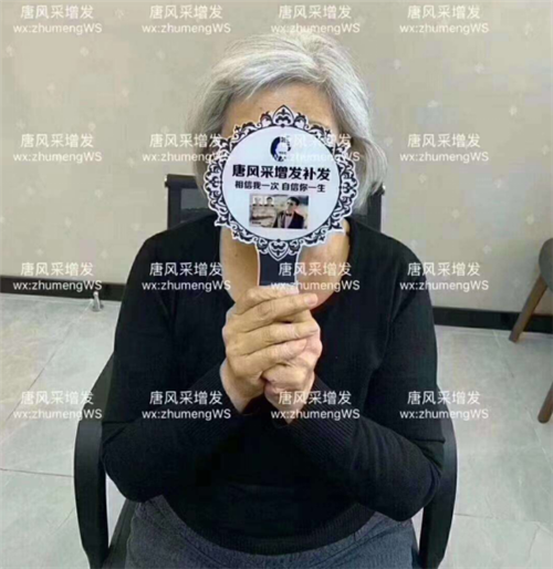 頭發(fā) 增發(fā)前