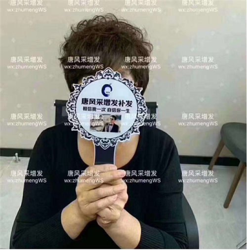 頭發(fā) 增發(fā)后