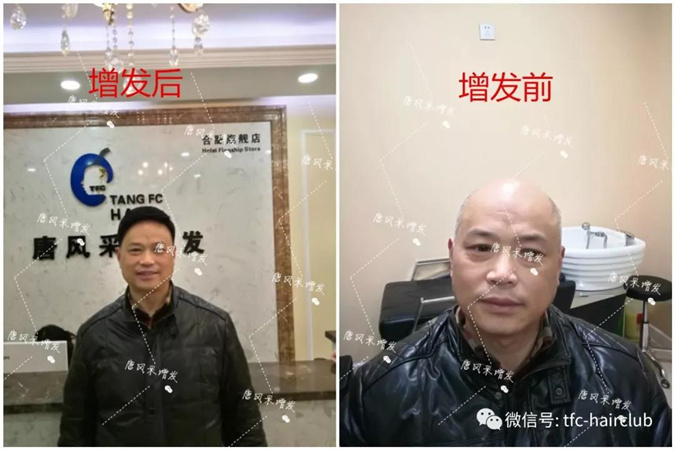 唐風采假發(fā)案例