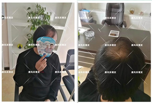 假發(fā)案例客戶(hù)