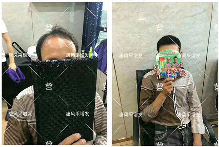 包頭哪里做真人假發(fā)的？真發(fā)都是從哪來的