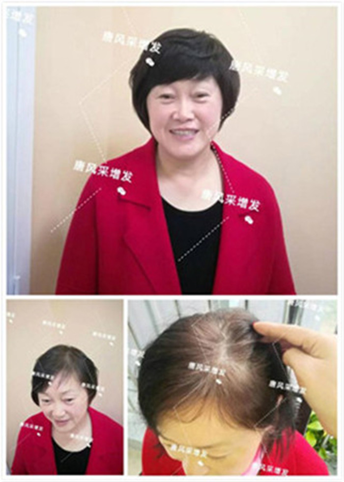 包頭假發(fā)什么牌子好？一定要選準(zhǔn)品牌精品