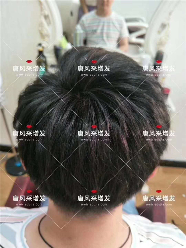 王先生在唐風(fēng)采假發(fā)后