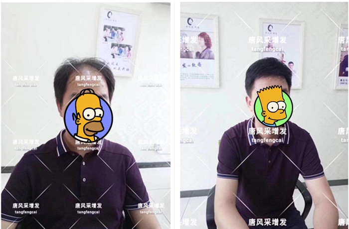 男老師戴假發(fā) 無(wú)痕假發(fā)