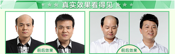 唐風采真實案例