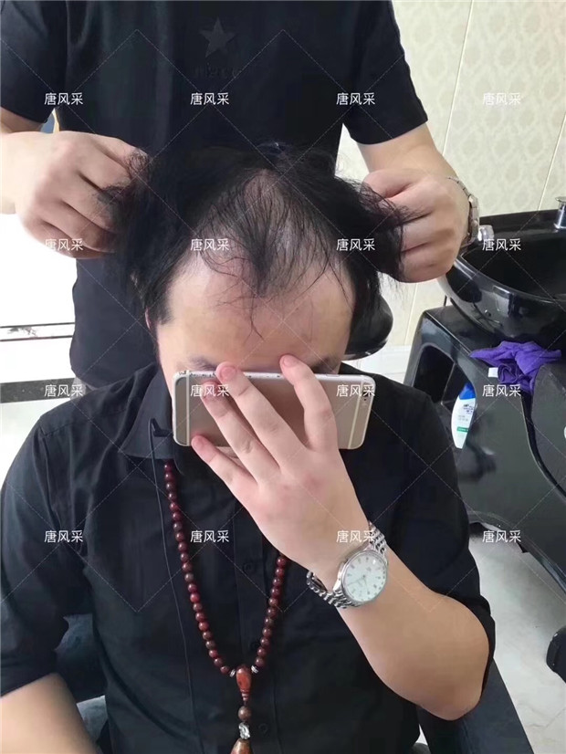 唐風采真實案例