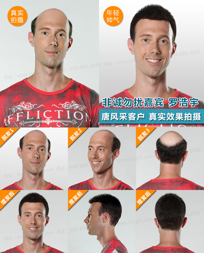 附近假發(fā)店 唐風(fēng)采真實(shí)案例