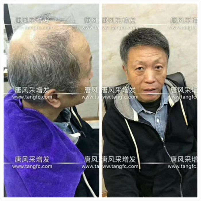 附近假發(fā)店 唐風(fēng)采真實(shí)案例