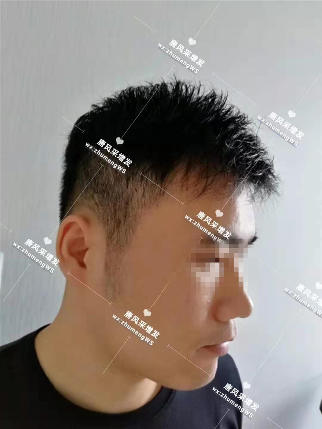 手工制作假發(fā) 無痕手工制作假發(fā)