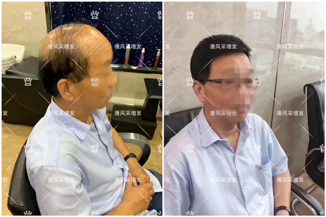 唐風(fēng)采假發(fā)中秋雙節(jié)鉅惠 唐風(fēng)采客戶案例